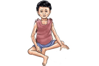  मधेसका बालबालिकामा बढ्यो कुपोषण, निःशुल्क उपचारमा जुट्यो प्रदेश  