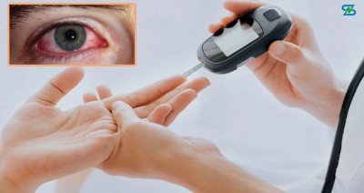  मधुमेह भएका व्यक्तिका लागि नियमित आँखा परीक्षण अत्यावश्यक 